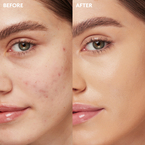 KIKO Milano Full Coverage 2-In-1 Foundation & Concealer mocno kryjący podkład i korektor 2 w 1 NR10 Neutral Rose 10 25ml
